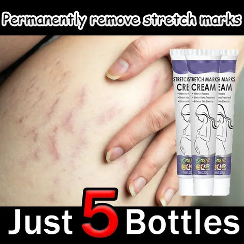 Stretch Marks Cream